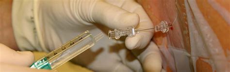 Axon Anaesthesia Associates