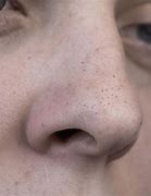 Image result for pores