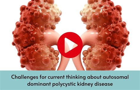 Challenges for current thinking about autosomal dominant polycystic ...