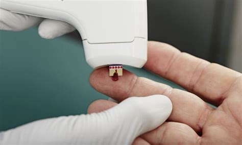 Image result for Point of Care Testing Devices