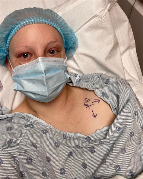 Mom, 30, Recounts Inflammatory Breast Cancer Diagnosis After Noticing ...