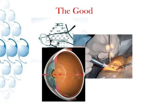 Image result for Occular Biometry