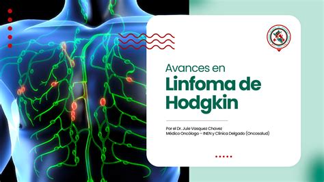 Avances en Linfoma de Hodgkin - SPOM
