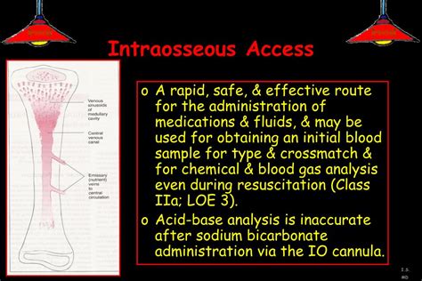 Image result for Intraosseous Access Procedure