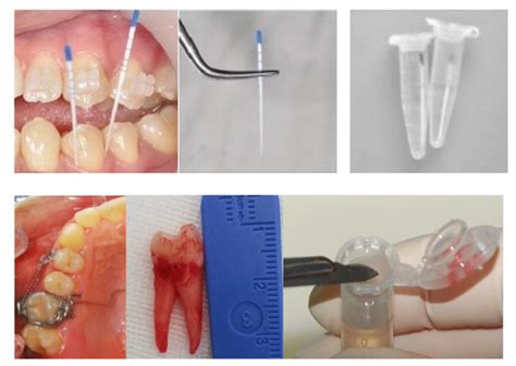 JCM | Special Issue : New Approaches and Technologies in Orthodontics