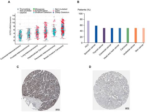 SSTR2-Targeted Theranostics in Hepatocellular Carcinoma