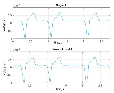 Signal Processing Algorithm Based on Discrete Wavelet Transform