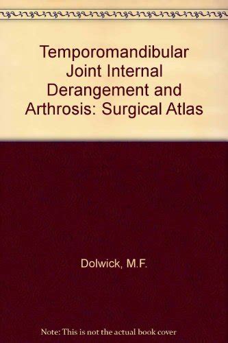 Buy Temporomandibular Joint Internal Derangement and Arthrosis ...