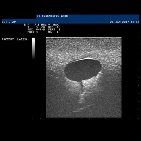 SONOtrain Breast Model with Cysts | 1019634 | P124 | Ultrasound Skill ...