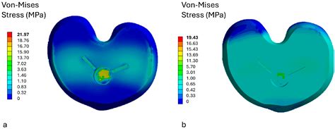 Evaluation of the Stress-Shielding Effect of a PEEK Knee Prosthesis. A Finite Element Study