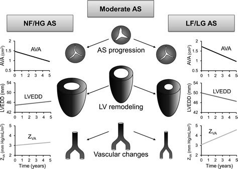 The spectrum of low-output low-gradient aortic stenosis with normal ejection fraction | Heart