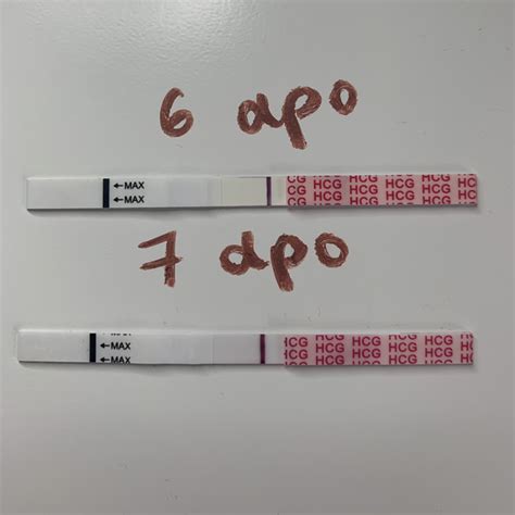 6DPO - Easy @ Home test | Mumsnet