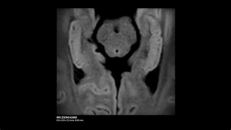 Philips - SmartPath to MR 7700