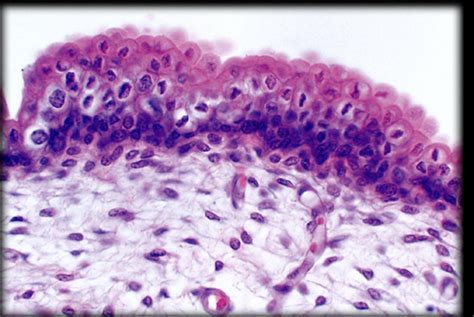 Image result for Transitional Epithelial Cells