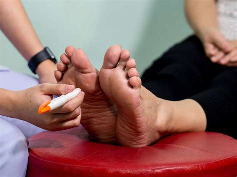 Diabetic neuropathy: Types, symptoms, and causes
