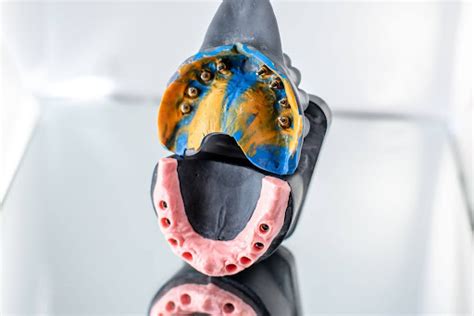 Image result for Immediate Denture Process