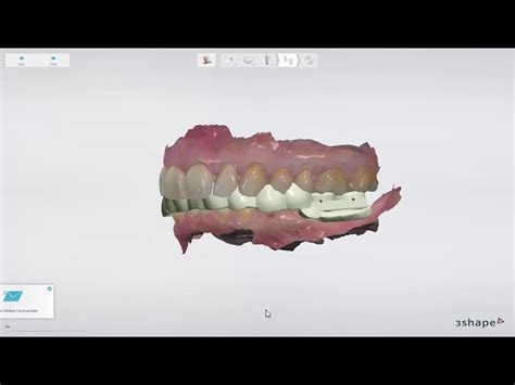 Image result for 3Shape How To