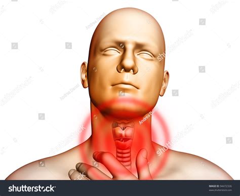 Medical Illustration Showing Pain Located In The Throat Area. Digital Illustration. - 94472326 ...