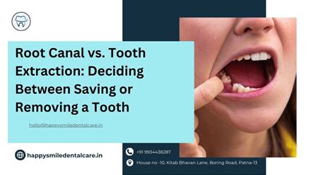 Difficult Tooth Root Extraction 的图像结果