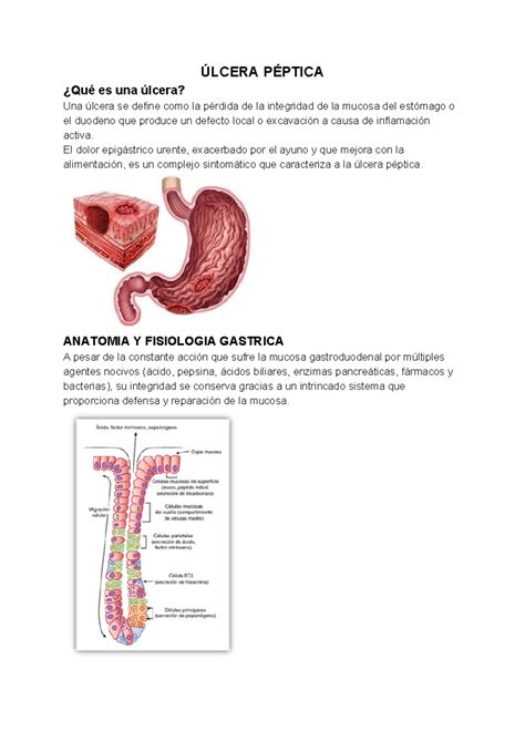 UP - Apuntes de ulcera péptica - ÚLCERA PÉPTICA ¿Qué es una úlcera? Una ...