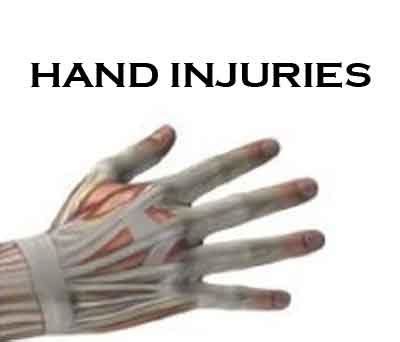 Hand Injuries: Standard Treatment Guidelines
