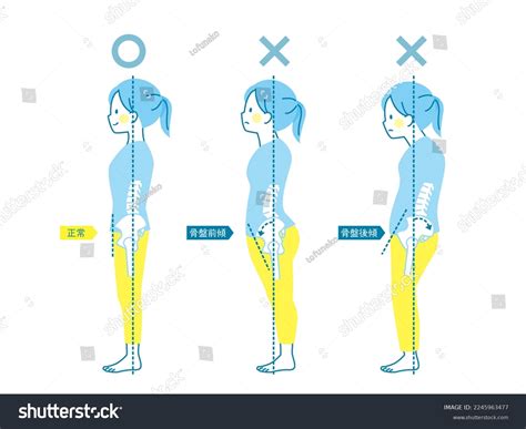77 Pelvic Tilt Posture Royalty-Free Images, Stock Photos & Pictures | Shutterstock