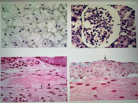 Identifying Tissue Types 的图像结果
