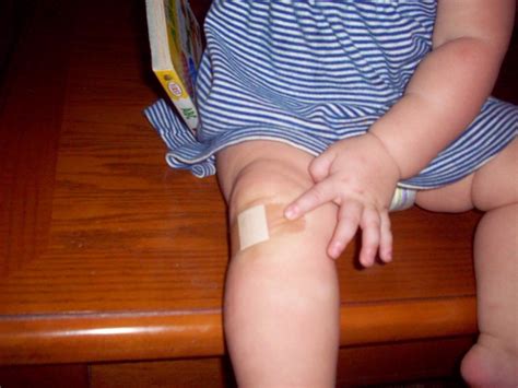 Image result for Boo Boo Hurt