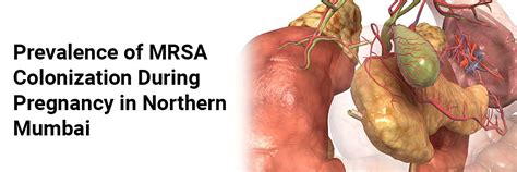 Prevalence of MRSA colonization during pregnancy in Northern Mumbai