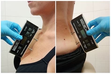 Targeted Motor Control Considering Sternal Position Improves Spinal ...