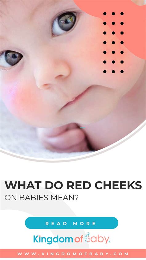 Red Cheeks Teething Mumsnet at Charli Fiaschi blog