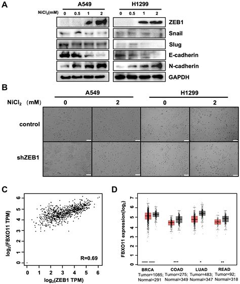 FBXO11 Mediates Ubiquitination of ZEB1 and Modulates Epithelial-to ...