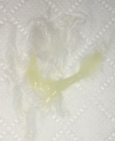 mucus plug vs discharge - prenatal vitamins