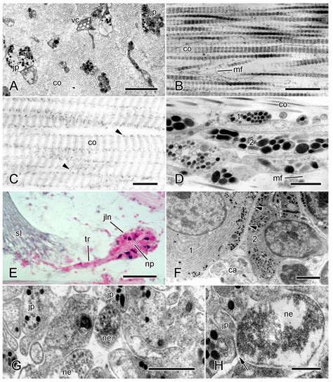 Mutable Collagenous Tissue: A Concept Generator for Biomimetic ...