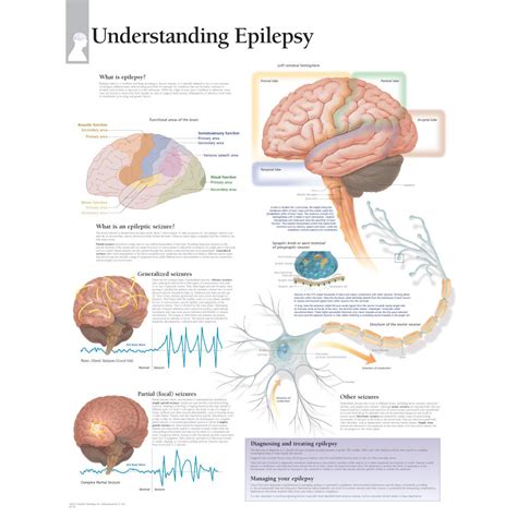 Scientific Publishing Understanding Epilepsy Chart