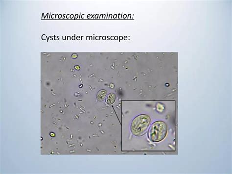 Classification of flagellates and giardia lamblia | PDF