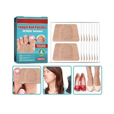 Nalacal Anti Fungal Nail Treatment Patches Toe Fungus Onychomycosis ...