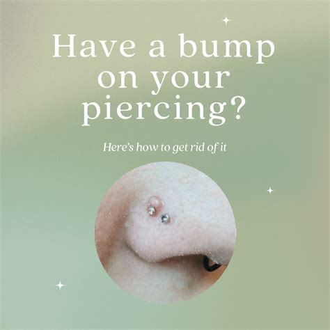 Nose Piercing Keloid Vs Bump at Todd Reno blog