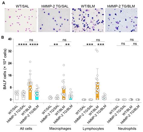 Amelioration of Pulmonary Fibrosis by Matrix Metalloproteinase-2 ...