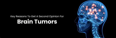 Get a Second Opinion for Brain Tumours- Book Now!