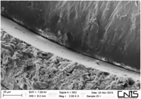 Comparison of Two Root Canal Filling Techniques: Obturation with ...