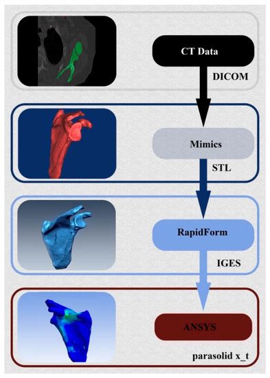 A Study of the Biomechanical Behavior of the Implantation Method of ...
