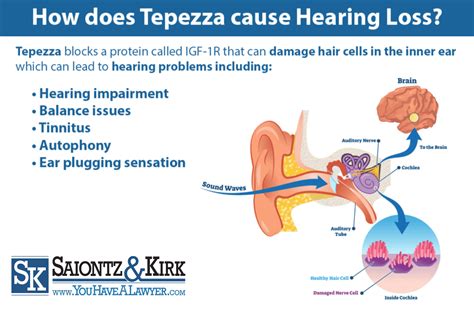 Tepezza Hearing Loss Side Effects | Saiontz & Kirk