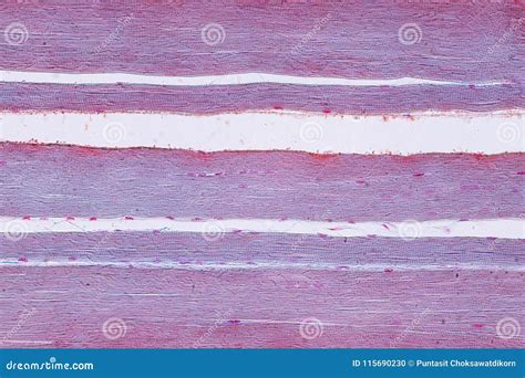 Image result for Skeletal Muscle Tissue Under Microscope