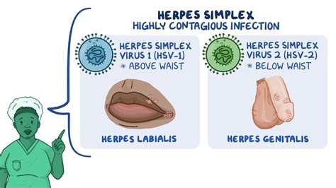 Is Hpv Herpes Simplex