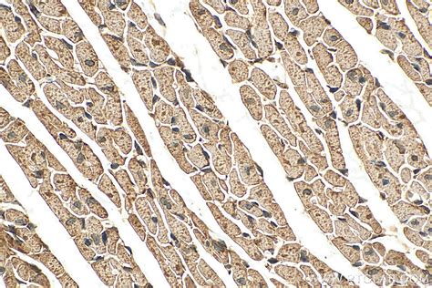 TOMM40 antibody (18409-1-AP) | Proteintech