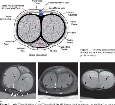 Penis Anatomy Radiology