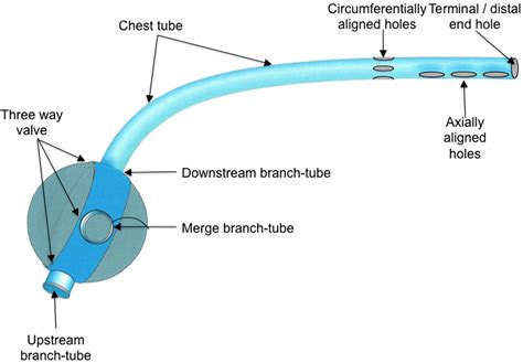 Novel Chest Tube Design to Alleviate Clogging and Facilitate Video ...
