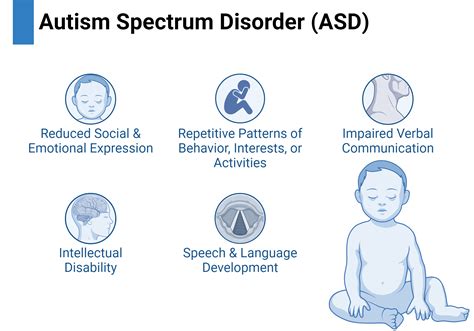 Image result for ASD Spectrum