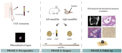 The Ability and Mechanism of nHAC/CGF in Promoting Osteogenesis and ...
